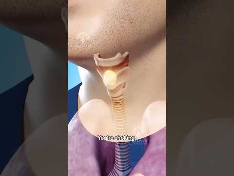 How to Survive Choking When You're Alone #short #choking - Creativelearning3d