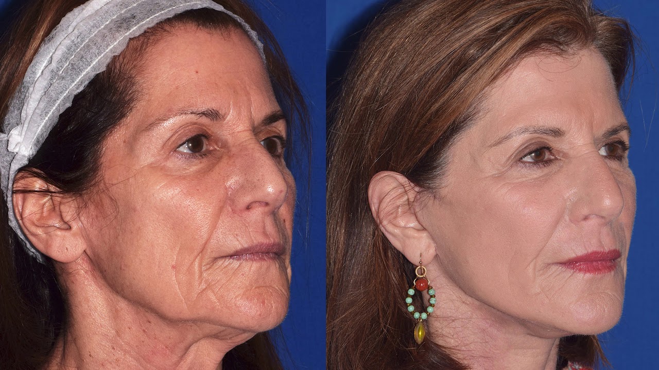 Robb Facial Plastic Surgery