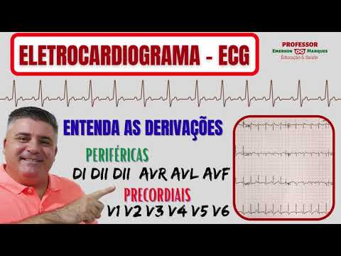 ELECTROCARDIOGRAM - PERIPHERAL AND PRECORDIAL LEADS