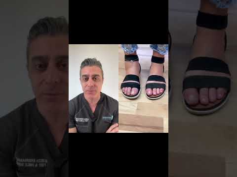 Prosthetic foot?