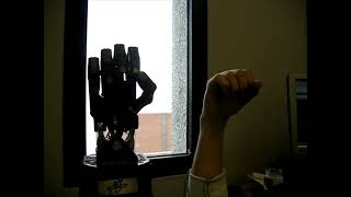 Newswise:Video Embedded fau-lands-1-2-million-nsf-grant-to-transform-prosthetic-hand-control