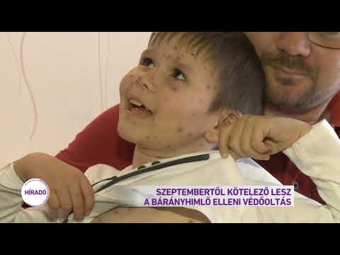 fájdalom ahol a csípőízület