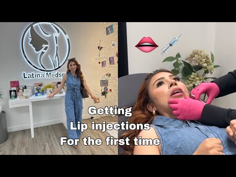 MY FIRST TIME GETTING LIP FILLER 😱