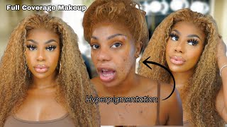 Everyday FULL COVERAGE Makeup Tutorial | Oily Acne-Proned Skin w/ Hyperpigmentation