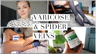 Spider Veins Treatment At Home