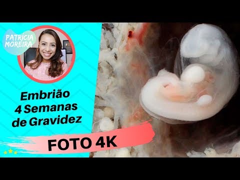 4K PHOTO - 4 Weeks Pregnant | Good Pregnancy - Patrícia Moreira