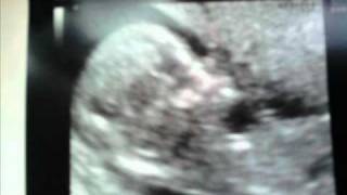 en t&#39;attendant ...