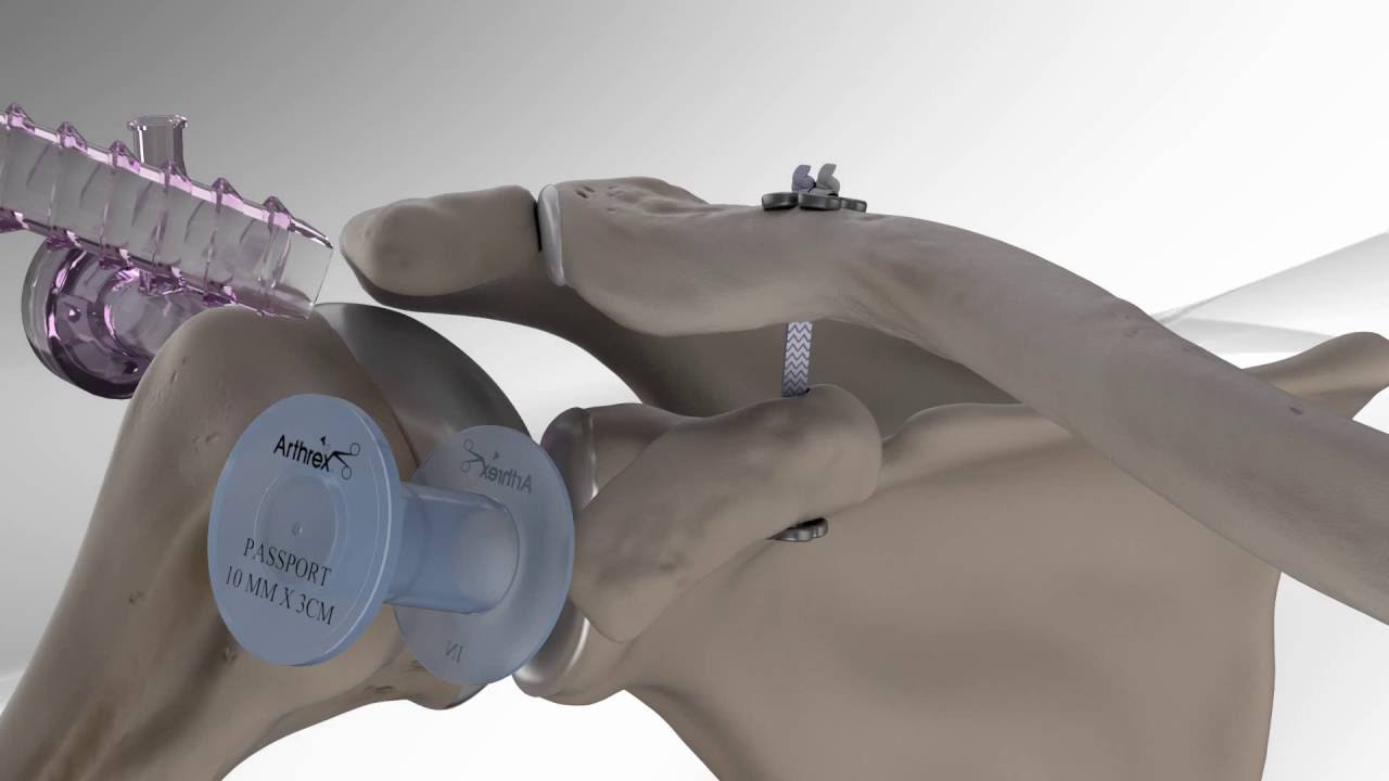 Henry A. Catacora Apaza-4