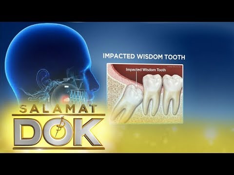 Salamat Dok: Expert talks about wisdom tooth