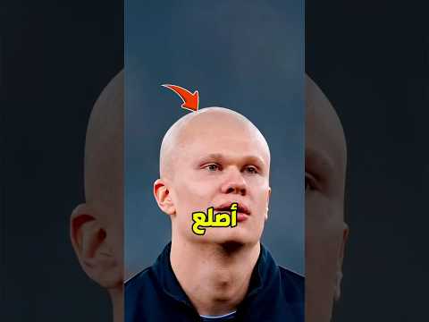 هل هالاند أصلع فعلاً؟ 😳