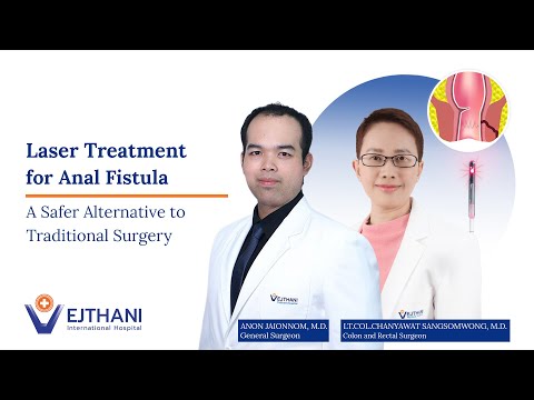 Treating Anal Fistula Through FiLaC — The Advanced Laser Technique  | Vejthani Hospital