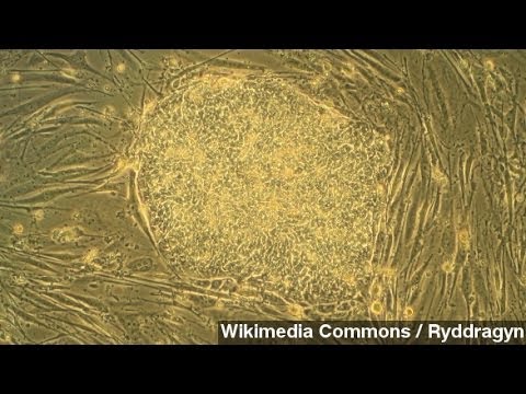 Flawed Stem Cell Study And The Problems With Peer Review