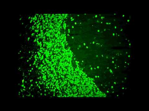 Jeka - Autoantikörper ft. Lokazo (Beat by. Jeka)