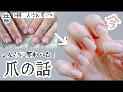 犬が爪を噛むのは普通のことですか?