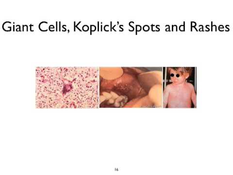 Virology 2013 Lecture #16 - Persistent infections