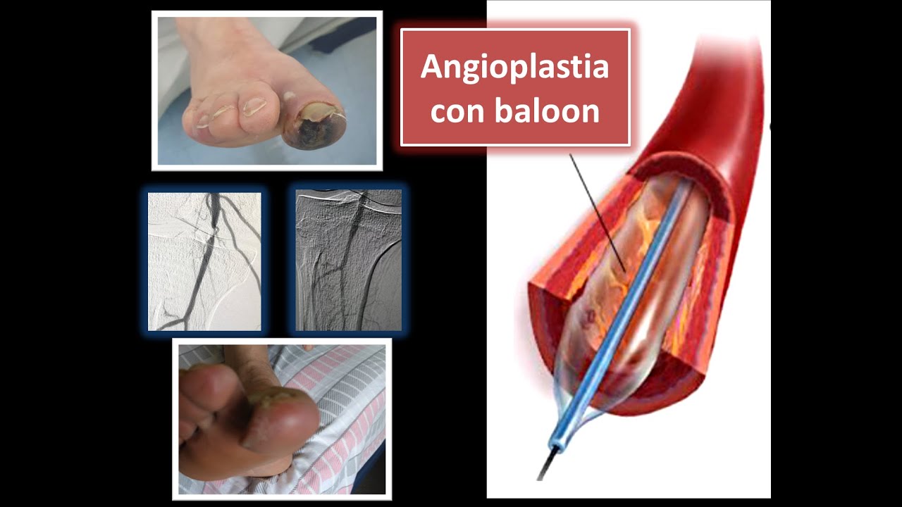 Riky Luis Perez Lucas-0