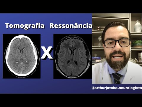 DIFERENÇA ENTRE RESSONANCIA MAGNETICA E TOMOGRAFIA