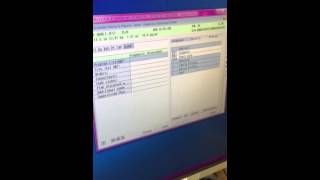 ICD-10 Chest Pain Qualifiers