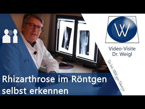 Fingerarthrose & Daumenarthrose im Röntgen selber erkennen🤓 Diagnostik & Radiologie Rhizarthrose
