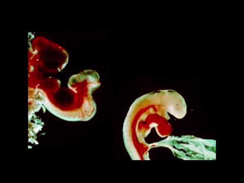 Orphx - Excruciate (Official Video)