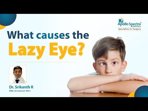 What happens if lazy eye is not treated?