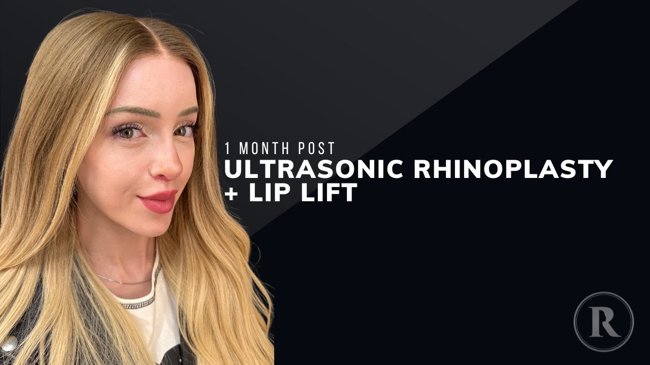 Robb Facial Plastic Surgery