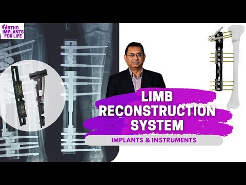 Limb Reconstruction System | LRS | Implants and Instruments