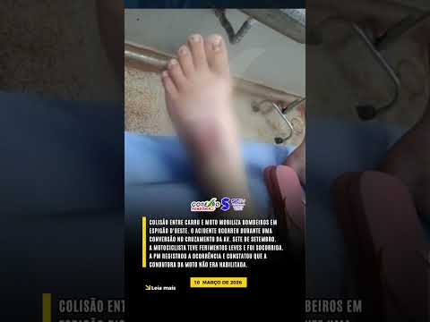 ACIDENTE NO CRUZAMENTO MOTO E CARRO COLIDEM EM ESPIGÃO D'OESTE