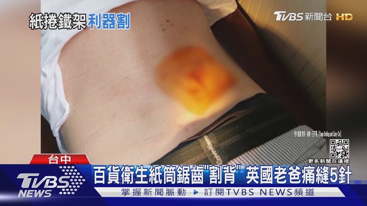 百貨衛生紙筒鋸齒「割背」 英國老爸痛縫5針