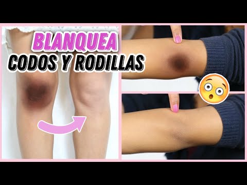 BLANQUEA TUS RODILLAS CODOS CUELLO Y AXILAS EN SOLO 5 MINUTOS CON ESTE EFECTIVO REMEDIO CASERO