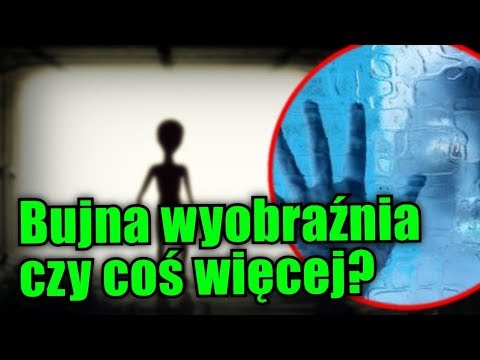 Koślawe zniekształcenie palców wielkiej korekty Koślawe kolana wikipedia