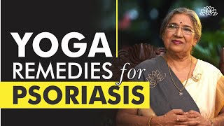 Best Home Remedies for Psoriasis | Dr. Hansaji Yogendra