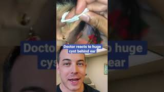 Crazy bump behind her ear drains so much stuff! | 208SkinDoc