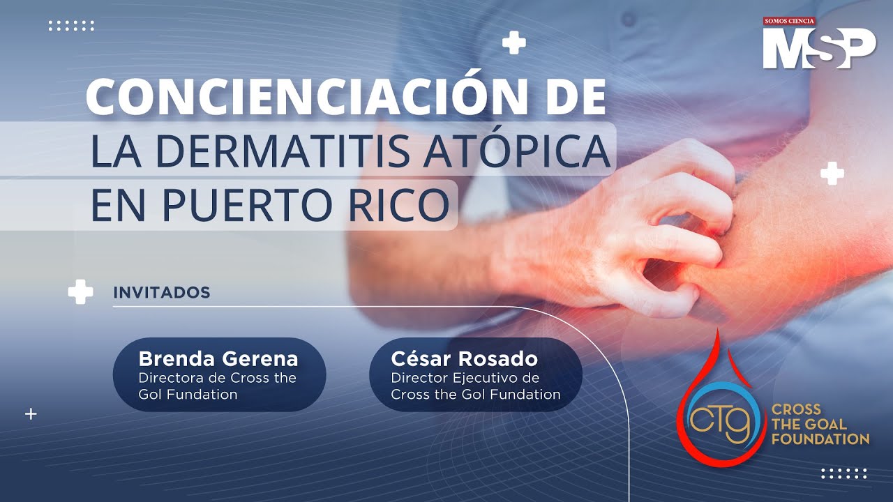 #ProgramaEspecial | Concienciación de la dermatitis atópica