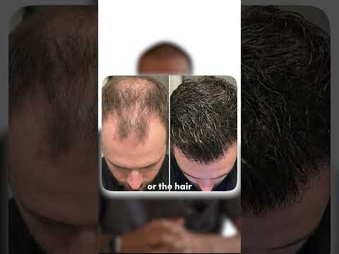 Logo of Innovative Stem Cell and Exosome Therapy for Hair Loss in Mexico