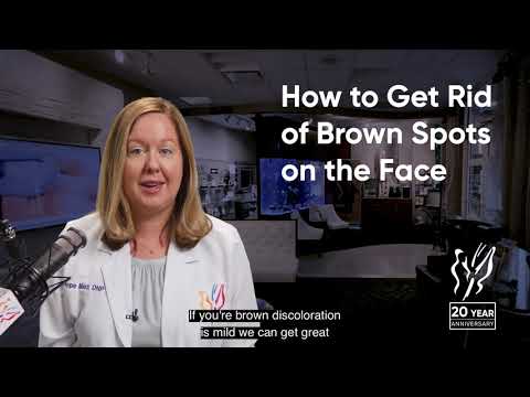 How To Get Rid Of Brown Spots on Face (Best Brown Spot...