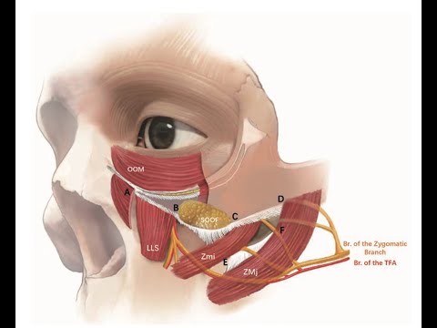 Anatomy Review--The SMAS (and its importance in facelifts) by Dr. Parsa Salehi