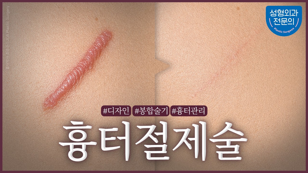 동영상 썸네일