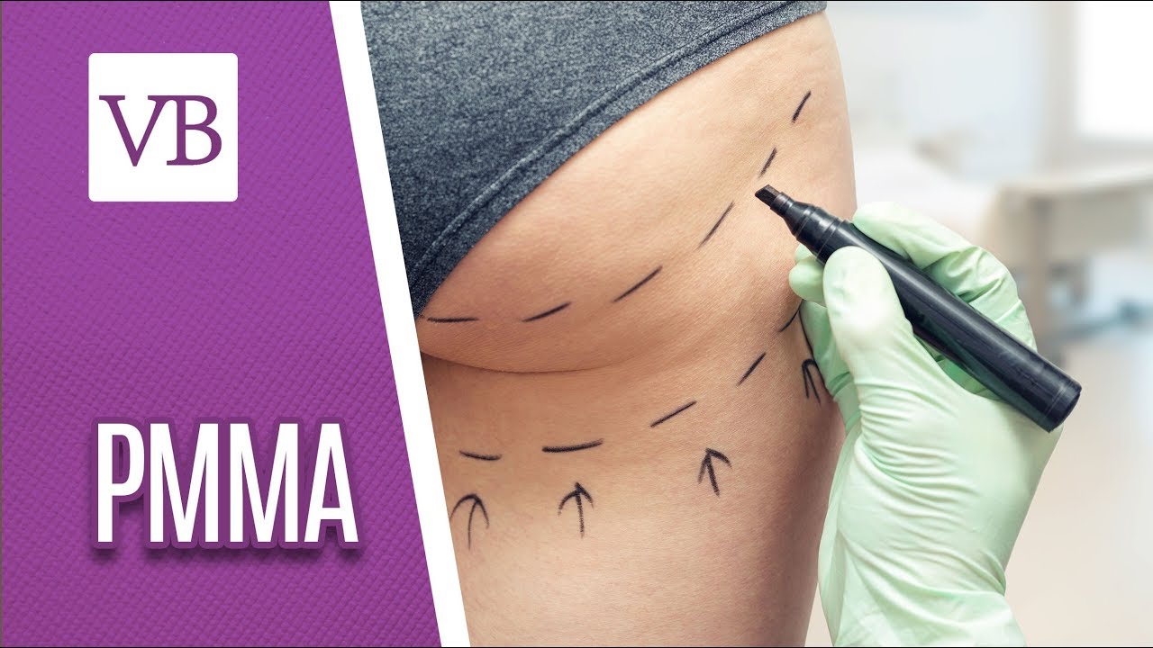 PMMA - Você Bonita (19/07/18)