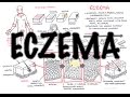 Eczema (Atopic Dermatitis) Overview