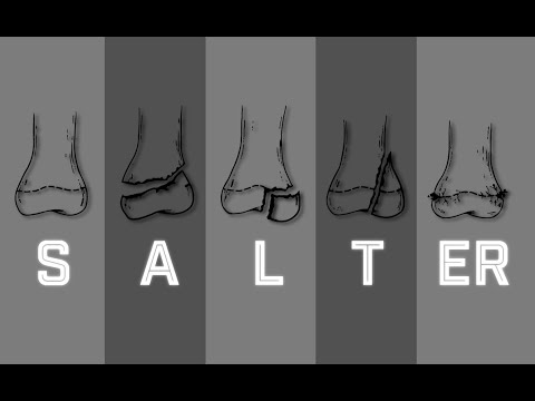 Salter Harris Fracture Classification - MEDZCOOL