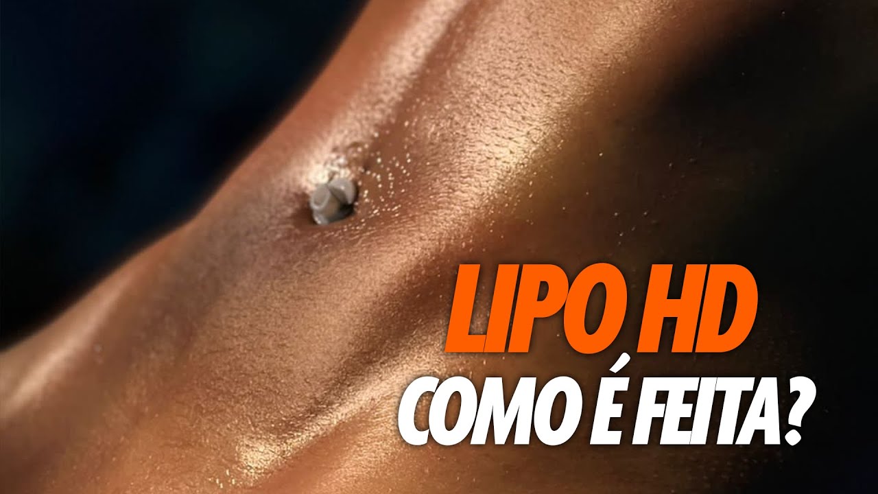 COMO E FEITA A CIRURGIA DE LIPO HD CIRURGIA PLASTICA