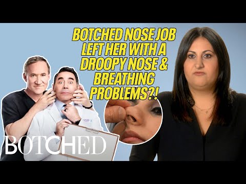 Pardis Had a BOTCHED Nose Job Leaving Her With Breathing Problems!? | Botched | E!