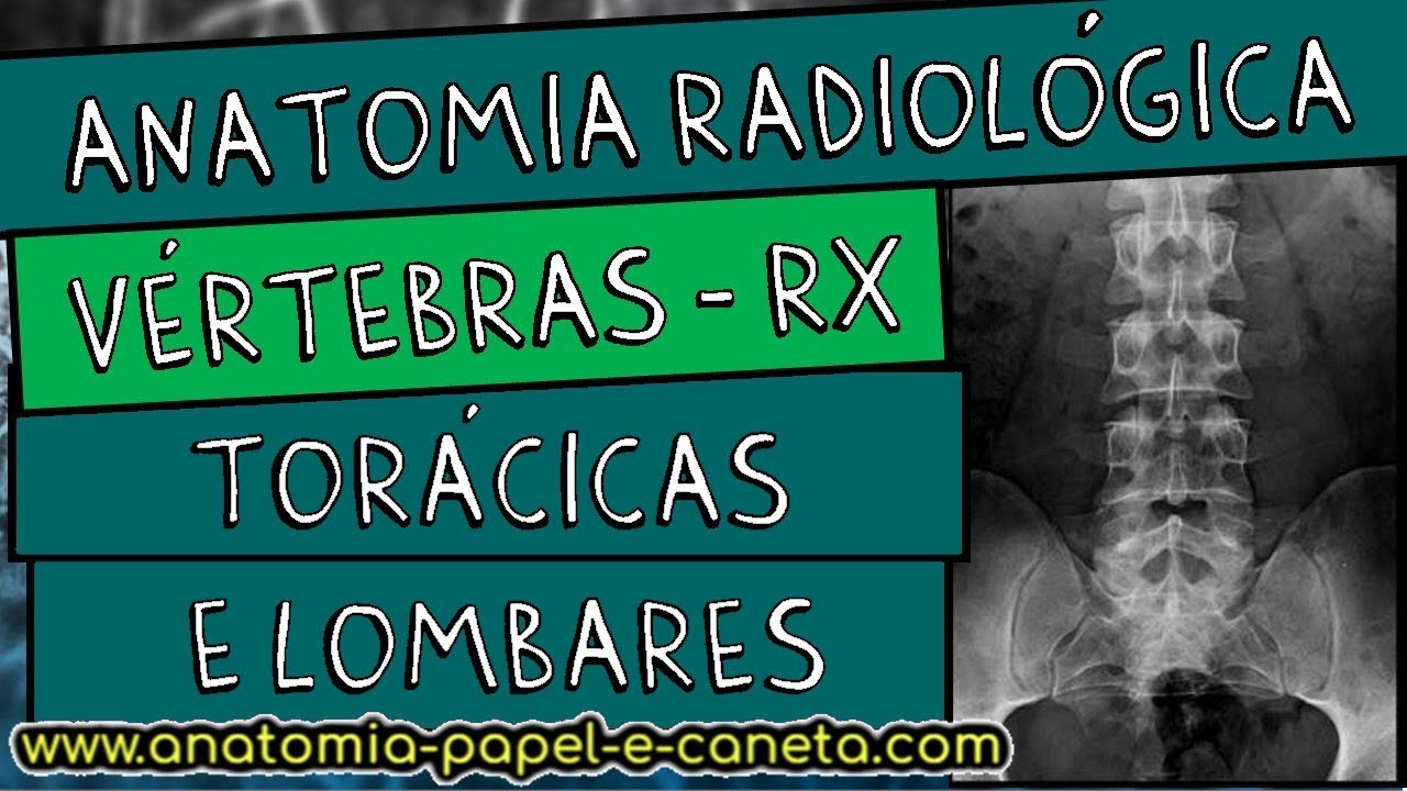Anatomia radiológica (RX) da coluna vertebral - TORÁCICA E LOMBAR - Sinal do CÃO ESCOCÊS