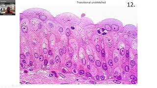 EPITHELIAL TISSUE Practice slides