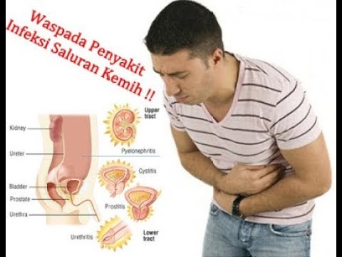 IPhone dan potensi Apa pil untuk mengambil untuk impotensi