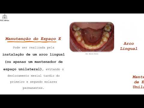 Gota #182 ESPAÇO E, ESPAÇO LIVRE DE NANCE OU LEEWAY SPACE: qual a diferença entre eles?