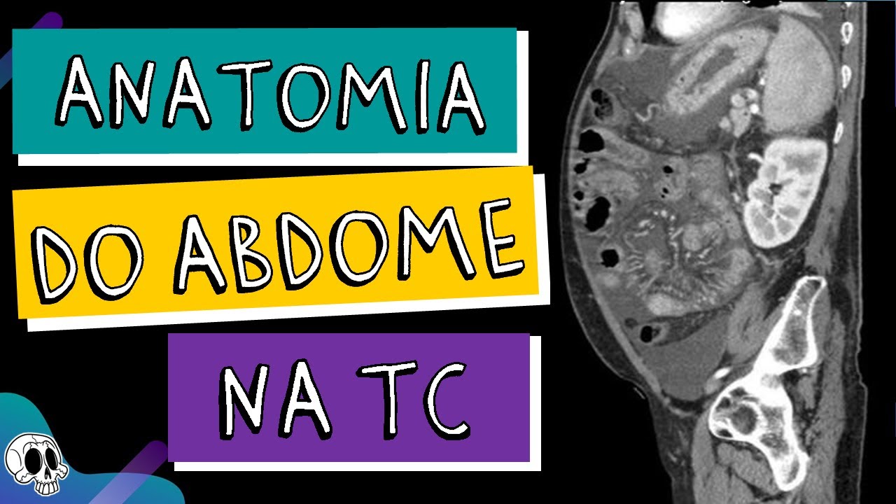 Anatomia do ABDOME na TOMOGRAFIA