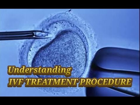 IVF Procedure Explained - Test Tube Baby