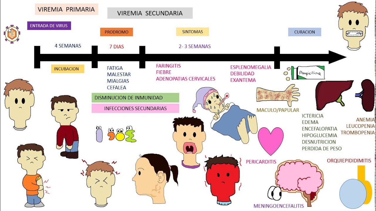 EPSTEIN BARR VIRUS , mononucleosis infecciosa